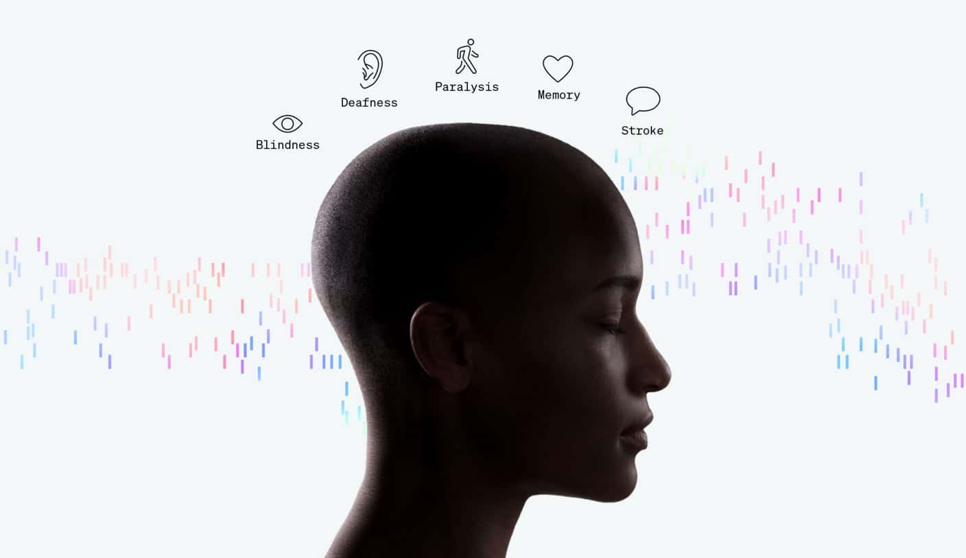 Neuralink má na krku žalobu. Práca s nakazenými opicami?