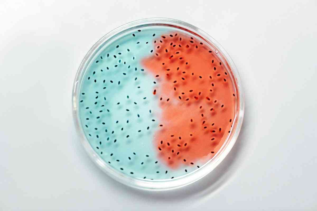 Čierna smrť trvala dlhšie vďaka genetickej mutácii baktérie